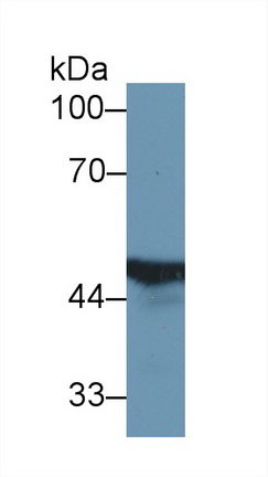 Polyclonal Antibody to Fumarylacetoacetate Hydrolase (FAH)