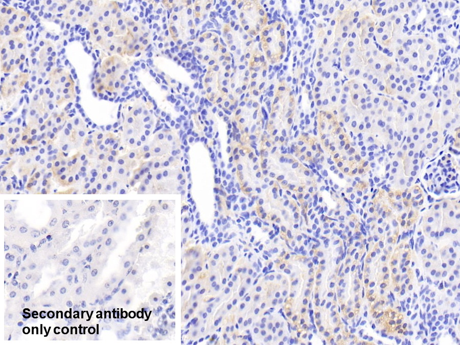 Polyclonal Antibody to Fumarylacetoacetate Hydrolase (FAH)