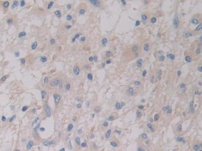 Polyclonal Antibody to Fumarylacetoacetate Hydrolase (FAH)