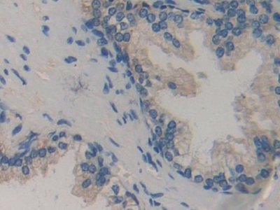 Polyclonal Antibody to Biglycan (BGN)