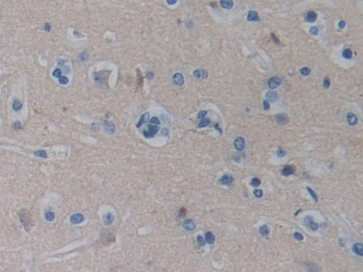 Polyclonal Antibody to Biglycan (BGN)