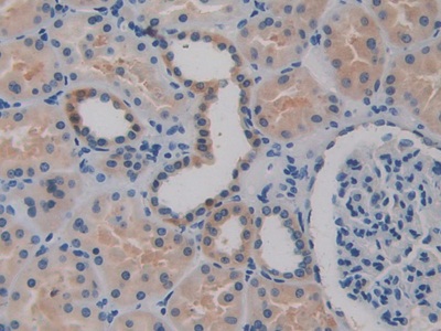 Polyclonal Antibody to Biglycan (BGN)