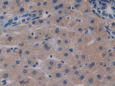 Polyclonal Antibody to Biglycan (BGN)