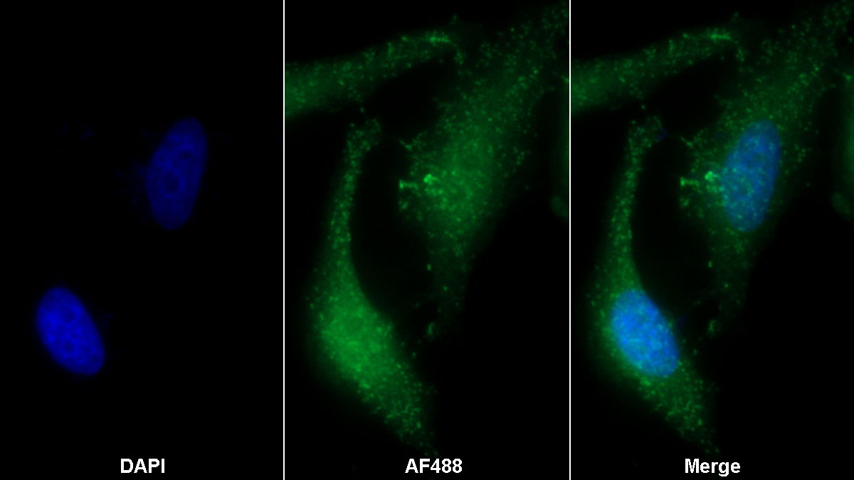 Polyclonal Antibody to Biglycan (BGN)