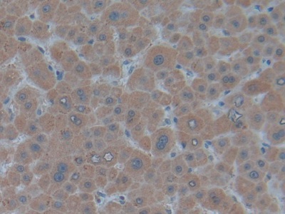 Polyclonal Antibody to Biglycan (BGN)