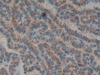 Polyclonal Antibody to Biglycan (BGN)