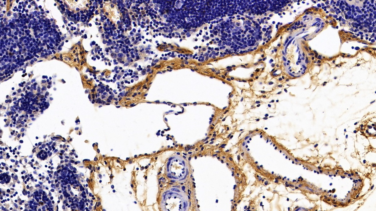 Polyclonal Antibody to Biglycan (BGN)