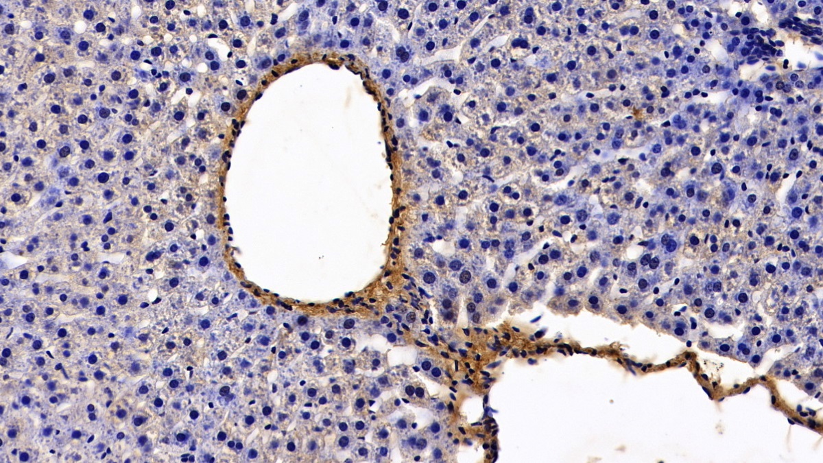 Polyclonal Antibody to Biglycan (BGN)