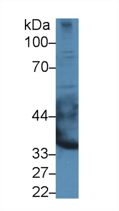 Polyclonal Antibody to Epiphycan (EPYC)