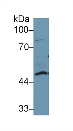 Polyclonal Antibody to Dolichyl Diphosphooligosaccharide Protein Glycosyltransferase (DDOST)