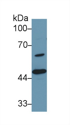 Polyclonal Antibody to Dolichyl Diphosphooligosaccharide Protein Glycosyltransferase (DDOST)