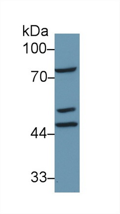 Polyclonal Antibody to Dolichyl Diphosphooligosaccharide Protein Glycosyltransferase (DDOST)