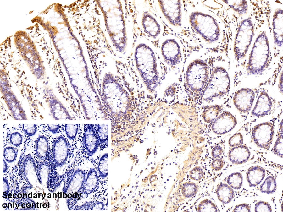 Polyclonal Antibody to D-Aspartate Oxidase (DDO)