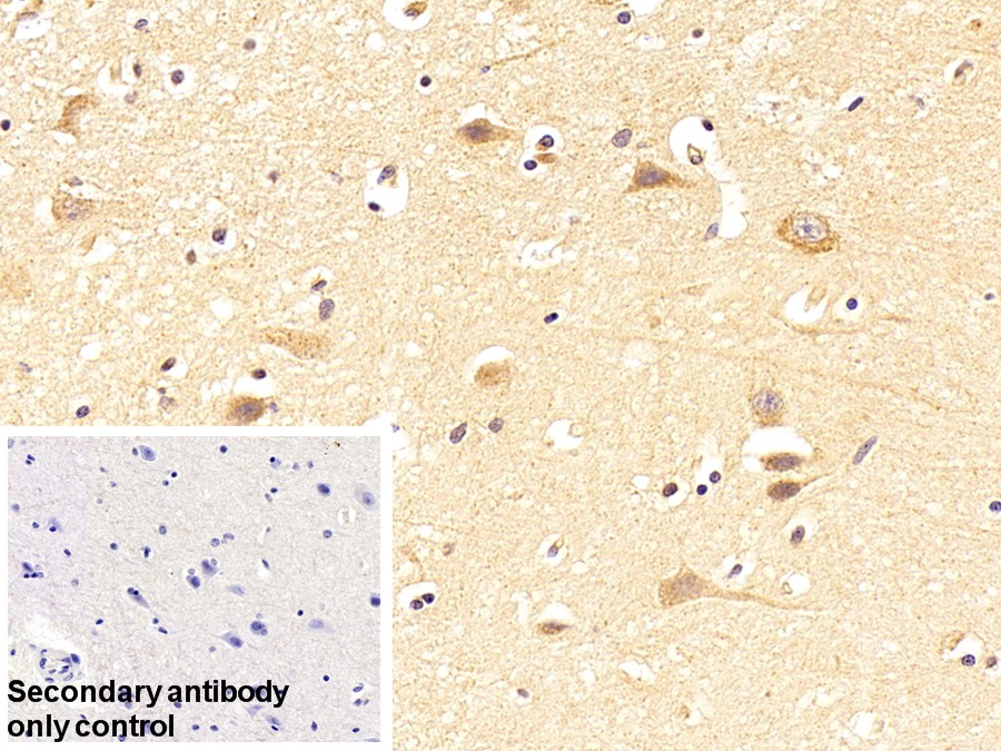 Polyclonal Antibody to D-Aspartate Oxidase (DDO)