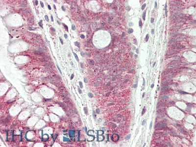 Polyclonal Antibody to DNA Damage Inducible Transcript 3 (DDIT3)