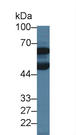 Polyclonal Antibody to Debranching Enzyme Homolog 1 (DBR1)