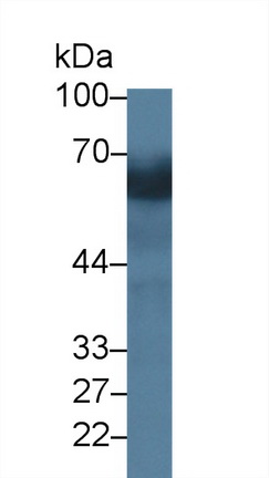 Polyclonal Antibody to Debranching Enzyme Homolog 1 (DBR1)