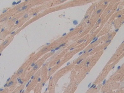 Polyclonal Antibody to Dual Adaptor Of Phosphotyrosine And 3-Phosphoinositides (DAPP1)