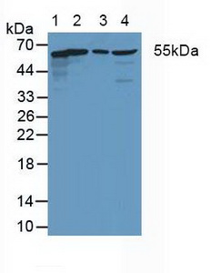 Polyclonal Antibody to Coxsackie Virus And Adenovirus Receptor (CXADR)