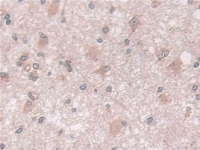 Polyclonal Antibody to Coxsackie Virus And Adenovirus Receptor (CXADR)