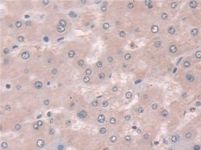 Polyclonal Antibody to Coxsackie Virus And Adenovirus Receptor (CXADR)