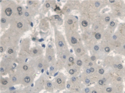 Polyclonal Antibody to Di-N-Acetyl Chitobiase (CTBS)