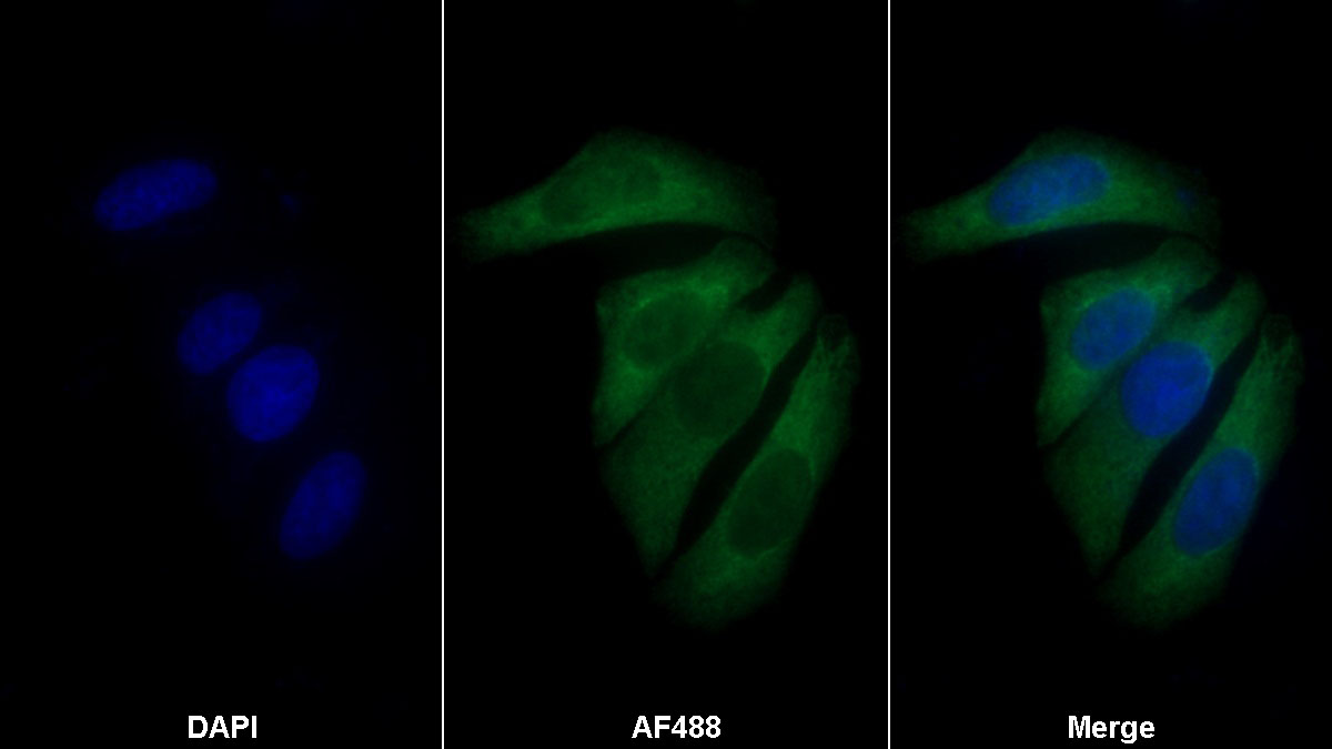 Polyclonal Antibody to Cancer/Testis Antigen 1B (CTAG1B)