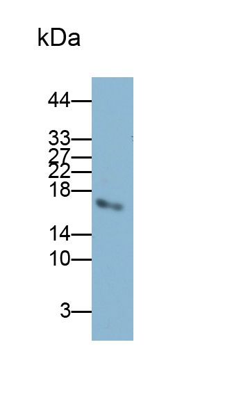 Polyclonal Antibody to Cancer/Testis Antigen 1B (CTAG1B)