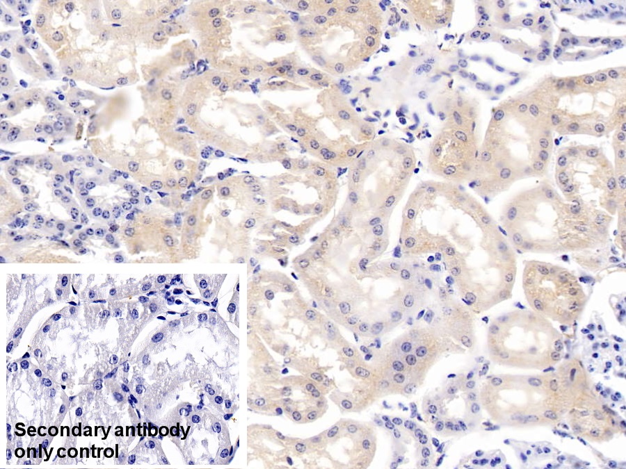 Polyclonal Antibody to Cystatin B (CSTB)