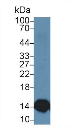 Polyclonal Antibody to Cystatin B (CSTB)