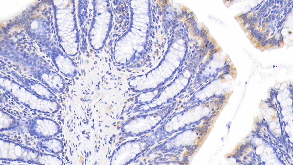 Polyclonal Antibody to Cystatin B (CSTB)