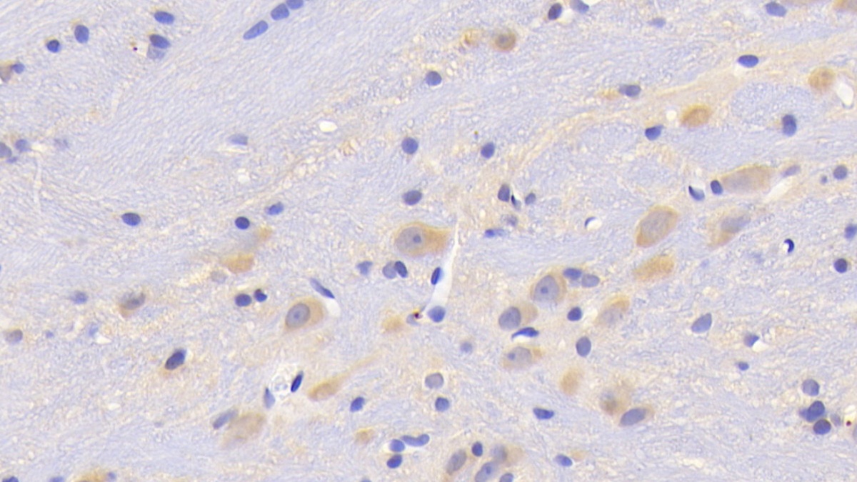 Polyclonal Antibody to Cystatin B (CSTB)