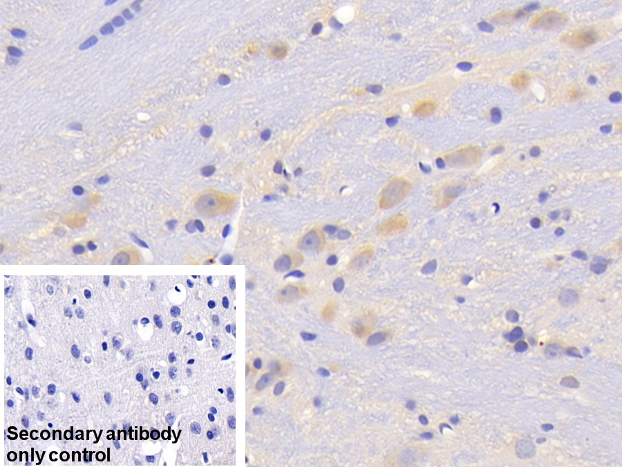 Polyclonal Antibody to Cystatin B (CSTB)