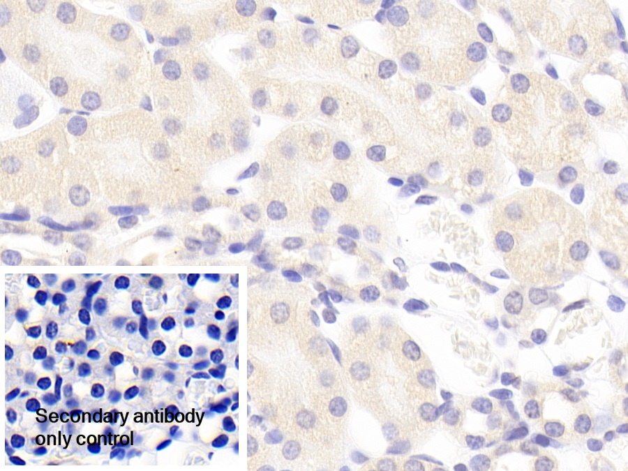 Polyclonal Antibody to Cartilage Associated Protein (CRTAP)