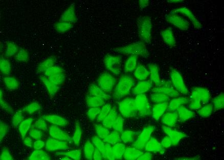 Polyclonal Antibody to Coactosin Like Protein 1 (COTL1)