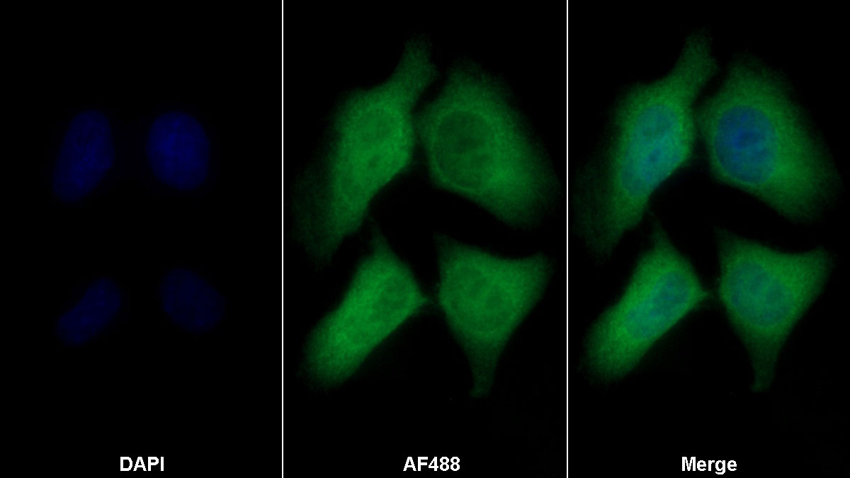 Polyclonal Antibody to Coactosin Like Protein 1 (COTL1)