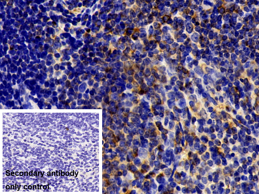 Polyclonal Antibody to Coactosin Like Protein 1 (COTL1)