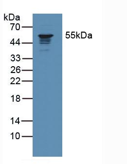 Polyclonal Antibody to Coronin 1A (CORO1A)