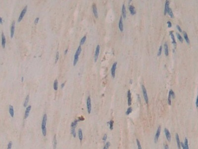 Polyclonal Antibody to Coronin 1A (CORO1A)