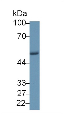 Polyclonal Antibody to Coronin 1A (CORO1A)