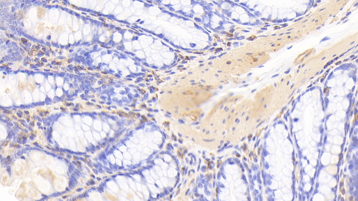 Polyclonal Antibody to Coronin 1A (CORO1A)