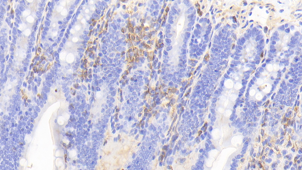 Polyclonal Antibody to Coronin 1A (CORO1A)