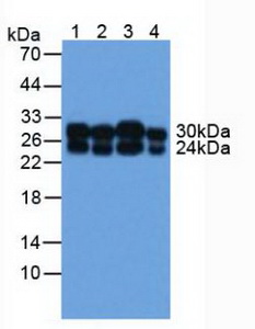 Polyclonal Antibody to Catechol-O-Methyltransferase (COMT)