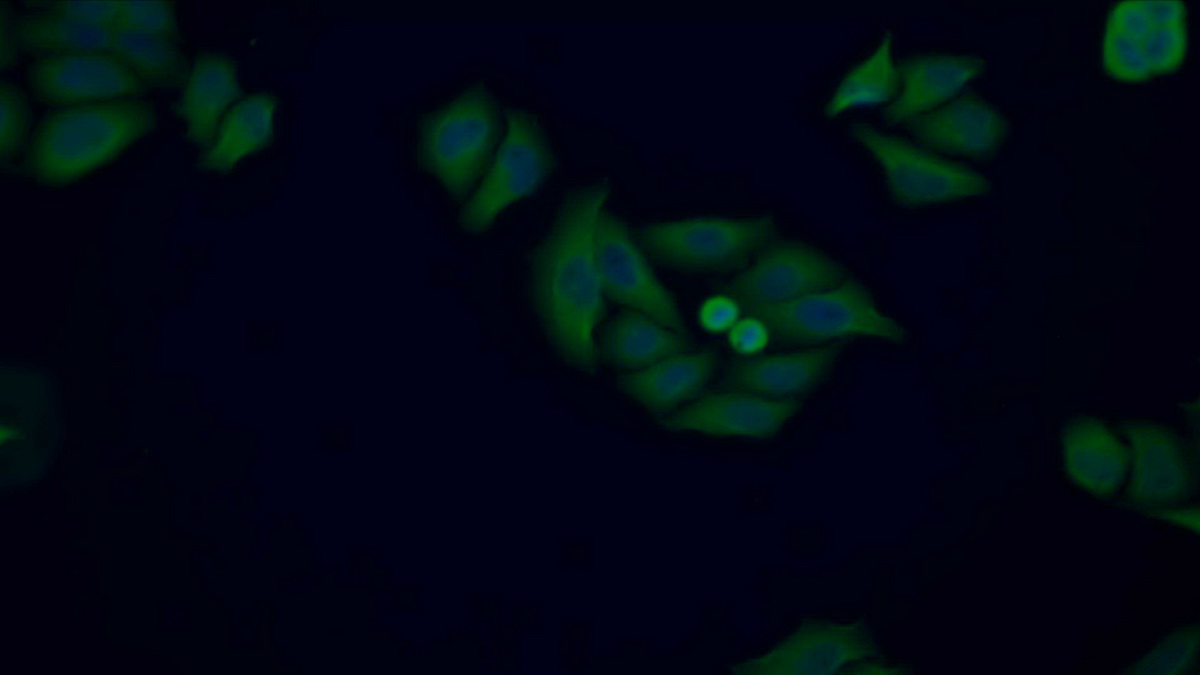 Polyclonal Antibody to Catechol-O-Methyltransferase (COMT)