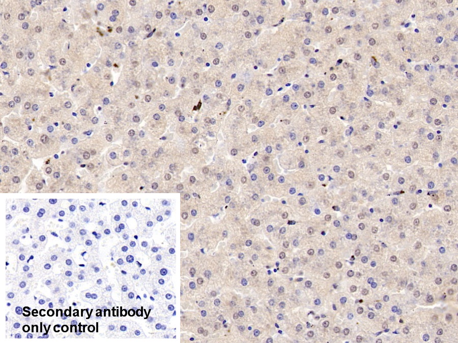 Polyclonal Antibody to Catechol-O-Methyltransferase (COMT)