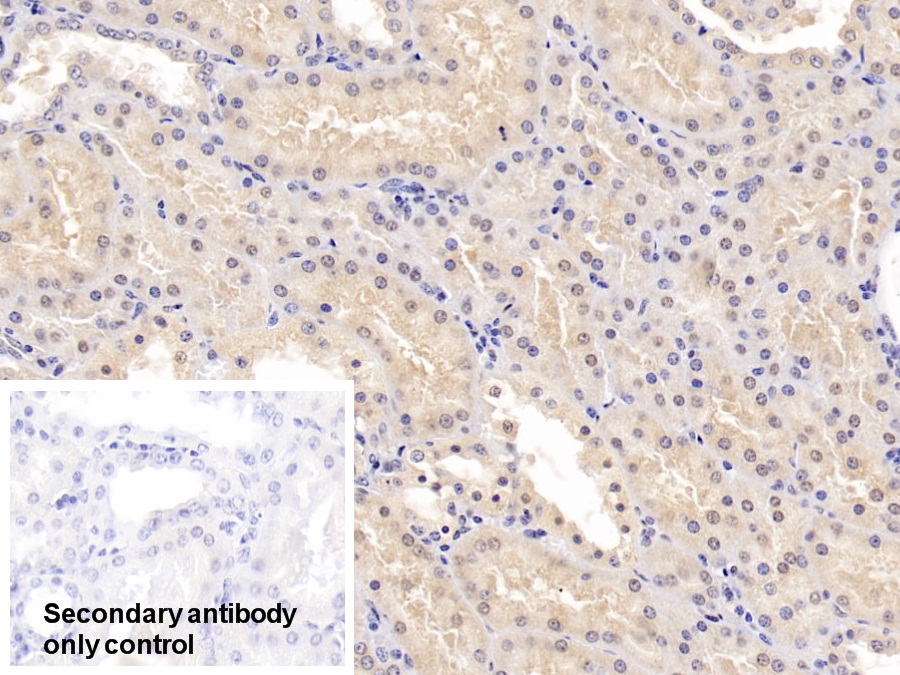 Polyclonal Antibody to Catechol-O-Methyltransferase (COMT)