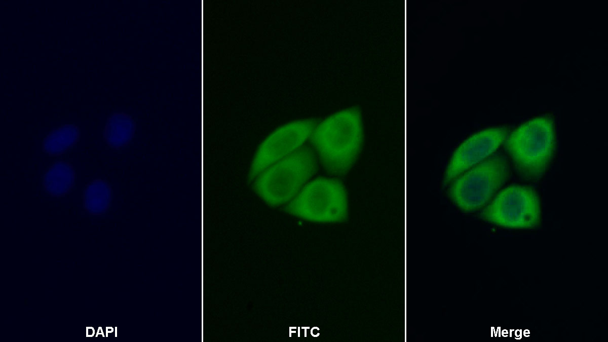 Polyclonal Antibody to Catechol-O-Methyltransferase (COMT)