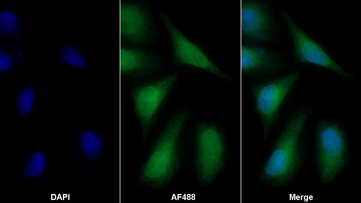 Polyclonal Antibody to Catechol-O-Methyltransferase (COMT)