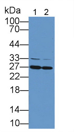 Polyclonal Antibody to Catechol-O-Methyltransferase (COMT)