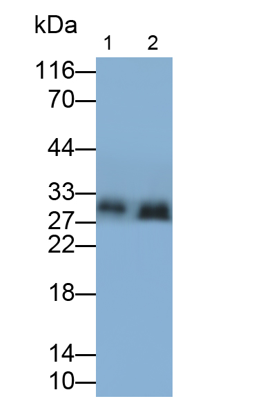 Polyclonal Antibody to Catechol-O-Methyltransferase (COMT)